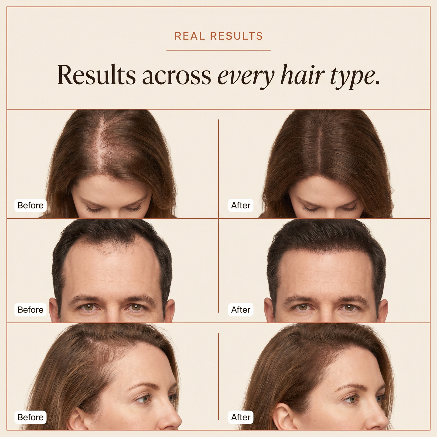 Rootulift™ Noticeable Hair Thicker Look in 4–8 Weeks