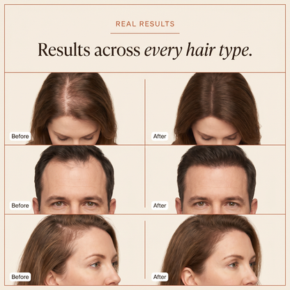 Rootulift™ Noticeable Hair Thicker Look in 4–8 Weeks